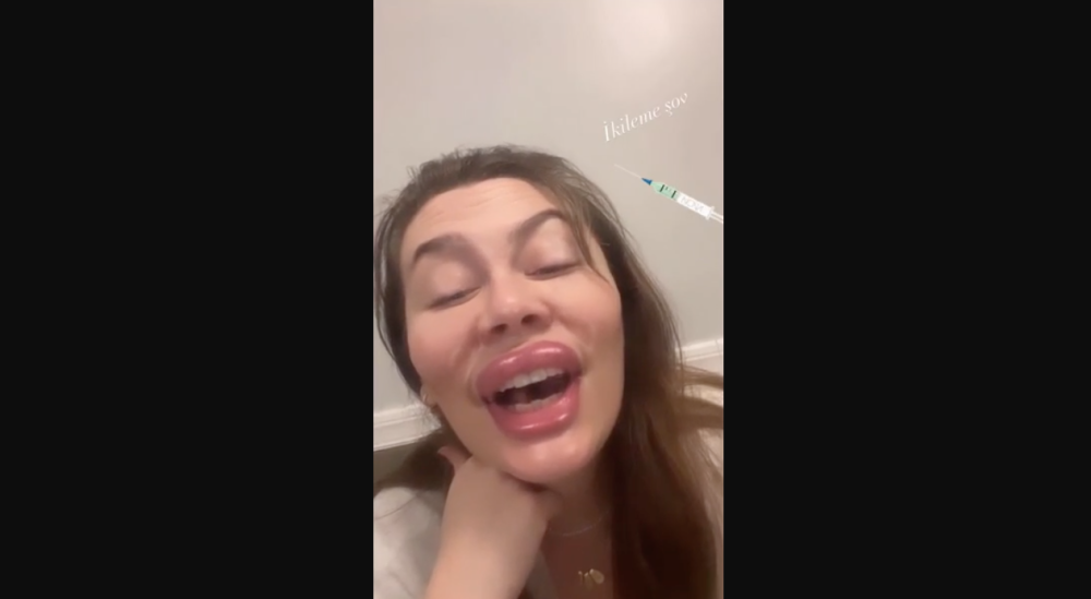 demet evgar in filtreli esprili estetik videosu olay oldu